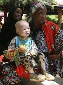 bocah albino bersama ibunya